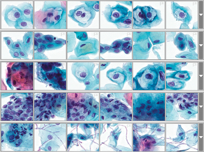 Volumetric image of cytology cells