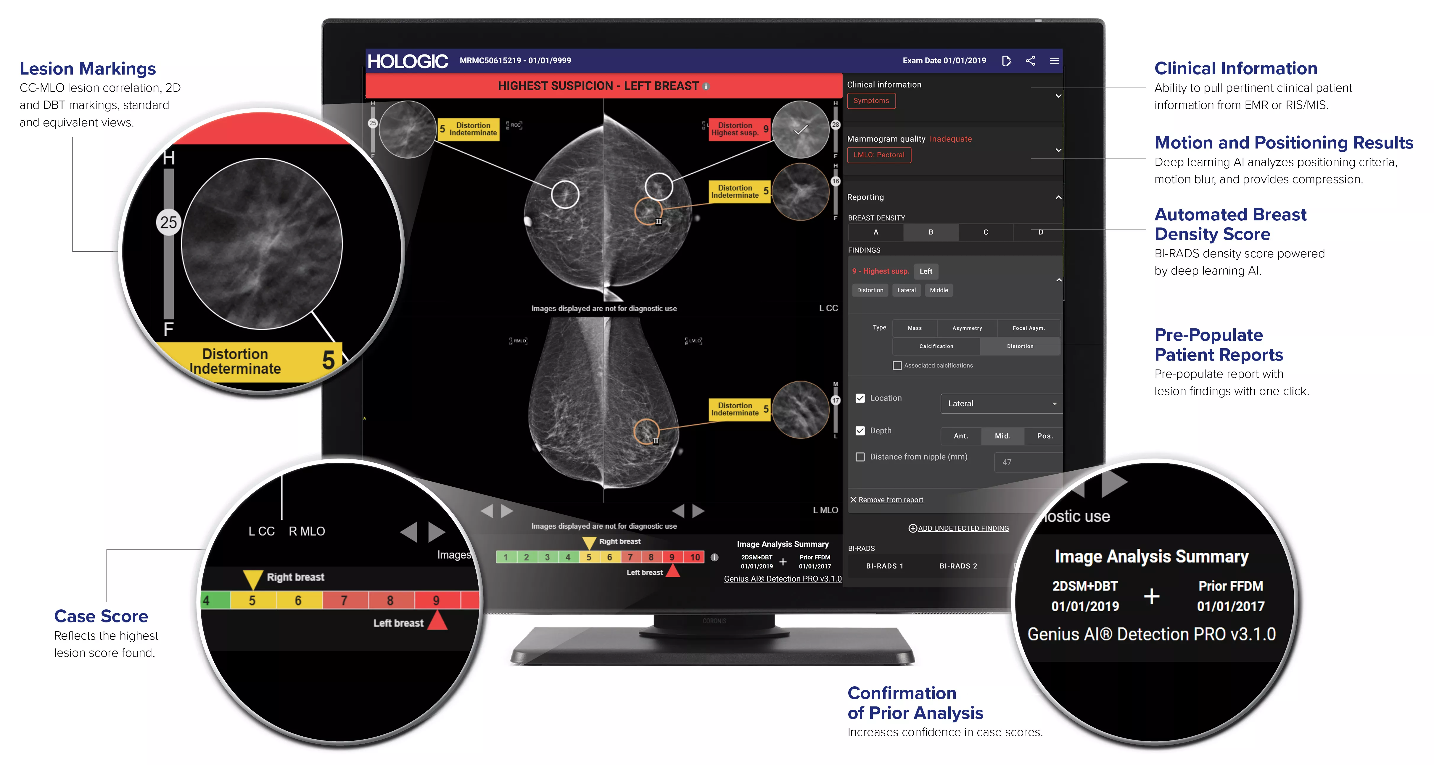 Advanced AI Designed for Greater Accuracy Screen