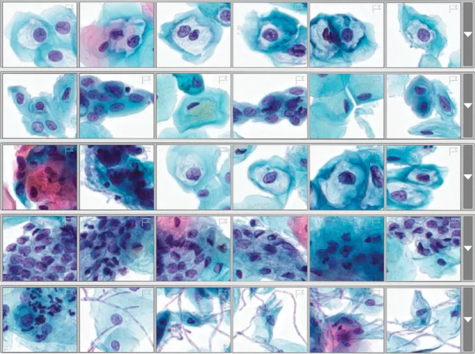 Volumetric image of cytology cells