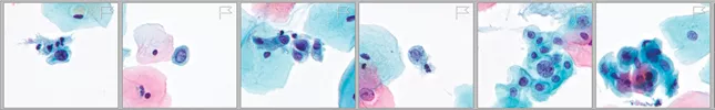 Image of cytology cells with correlated numbers