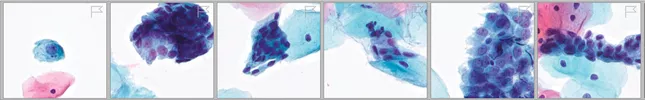 Image of cytology cells with correlated numbers